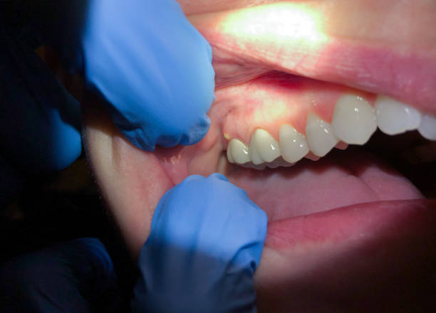 Professional Emergency Dentist in CT