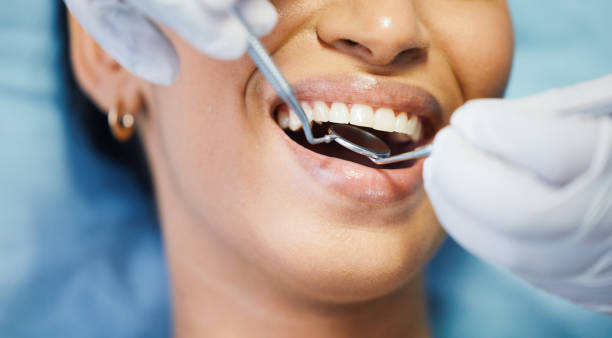 Best Emergency Broken Tooth Repair in Noroton, CT