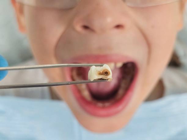 Best Emergency Dental Care for Trauma or Injury in Noroton, CT